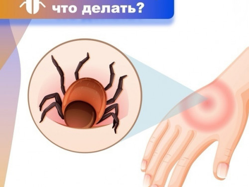 Укусил клещ: что делать? 