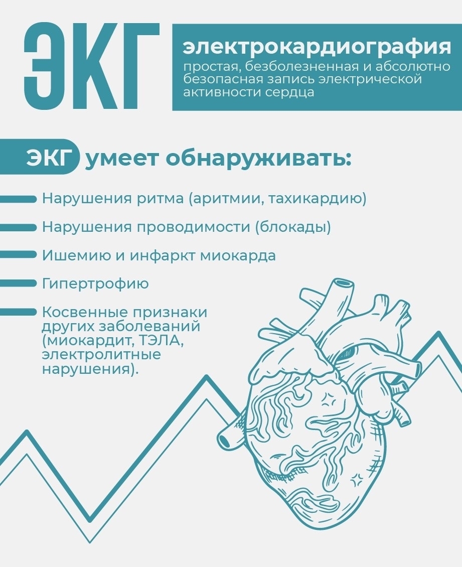 Что показывает ЭКГ? И почему это «золотой стандарт»?