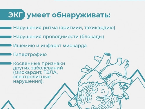 Что показывает ЭКГ? И почему это «золотой стандарт»?